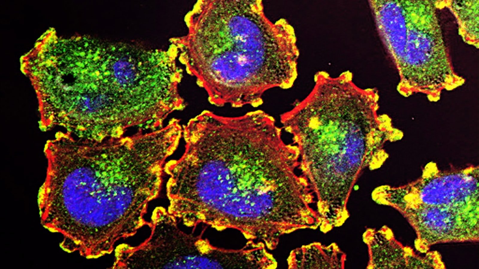 1. Unleashing the Power of A/B Testing: Optimizing E-commerce Sales for Maximum Potential